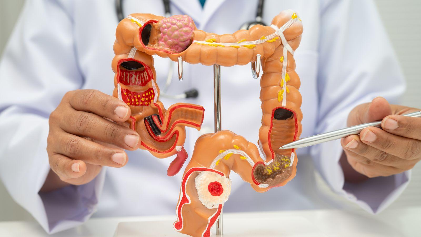 colon health tips, improve colon health, colon health lifestyle, gut health solutions, digestive health products, colon cleansing natural remedies, best probiotics for colon health, healthy habits for colon, colon health diet plan, colon detox supplements